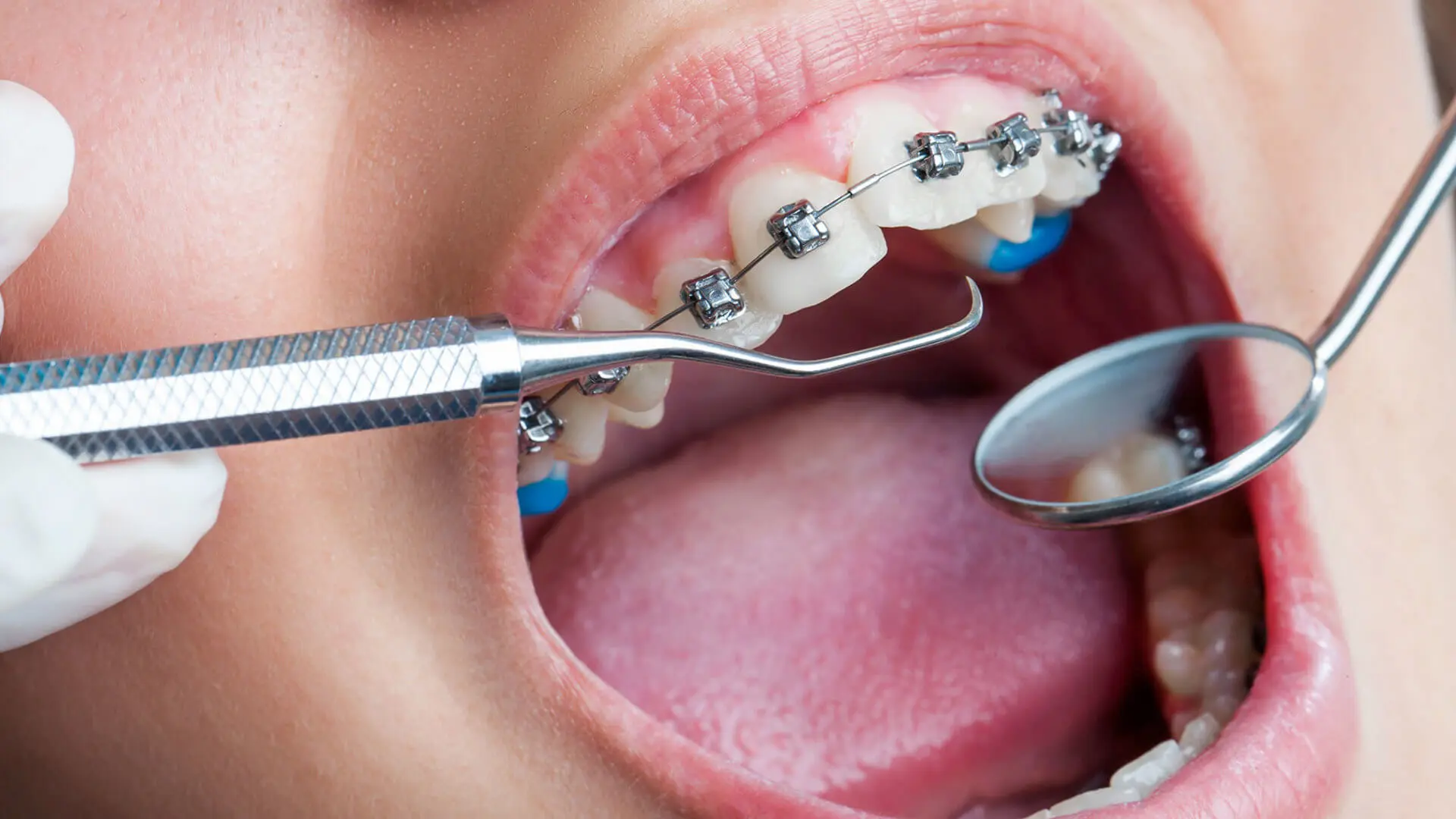 ortodontist ne yapar